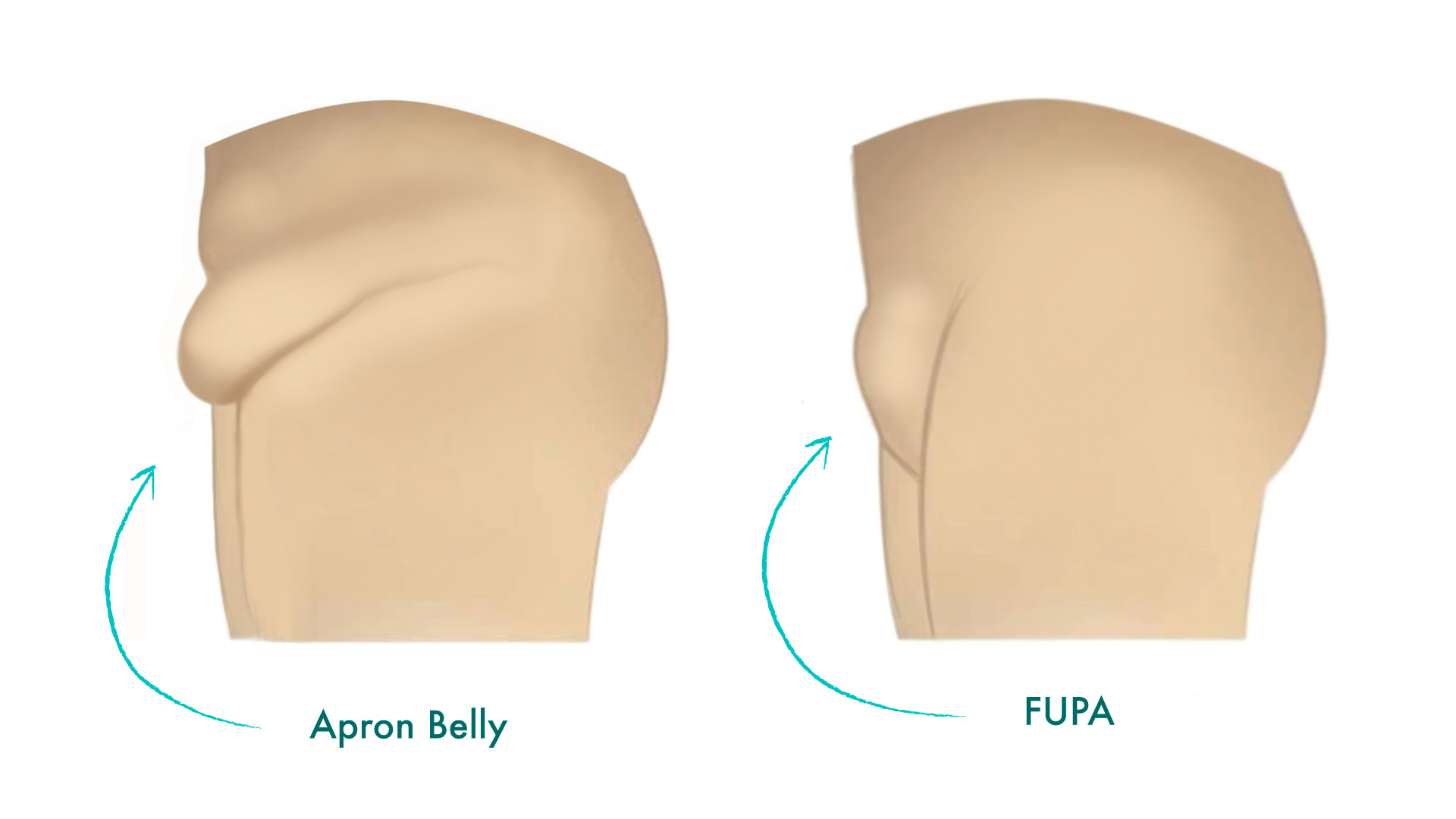 FUPA